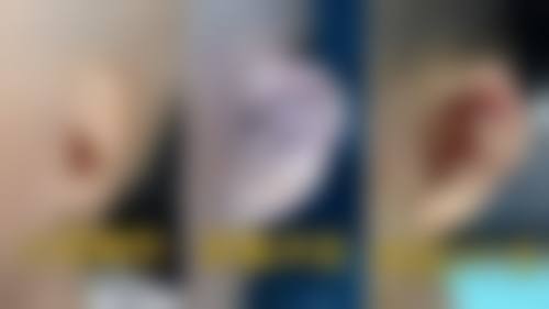 二、济南即美整形医院怎么样？