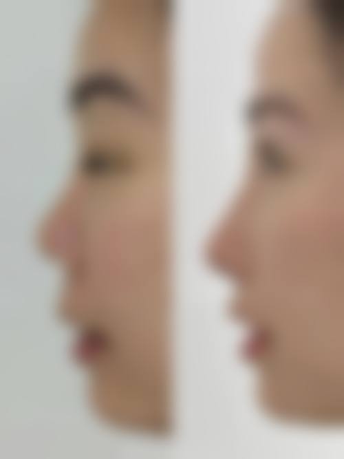 七、四川资阳精美源医疗美容预约方式