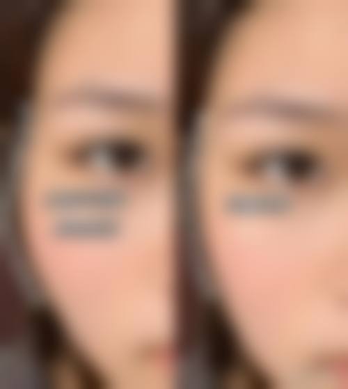 九、青岛星美医疗美容诊所真实的患者评价