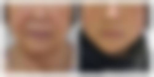 七、长春伶秀致美整形医院预约方式