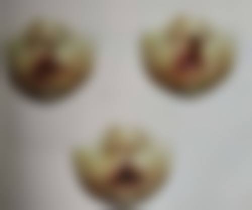 一、怎样去掉脸上的烫伤疤痕之疤痕评估与基础护理