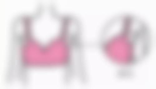 内取眼袋后多久恢复正常？恢复时间、阶段及护理重点全揭秘！ 