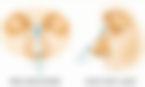 三、怎样去掉脸上的烫伤疤痕之药物治疗