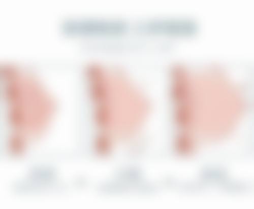 三、不开刀不手术双眼皮方式的注意事项