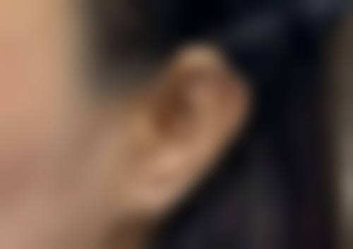 九、临沂艺生医疗美容门诊部真实的患者评价