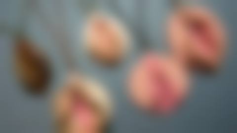 八、潍坊伊博士医学整形美容门诊部真实的患者评价