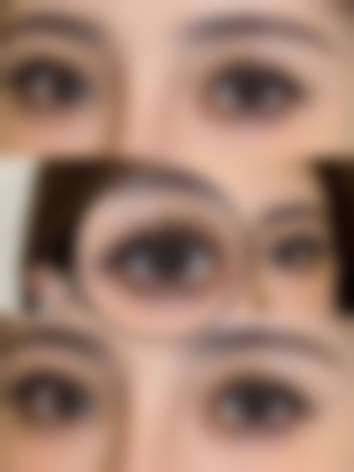 九、北京石榴医疗美容诊所真实的患者评价