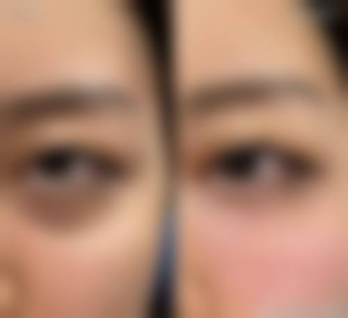 四、天津珍熙美医疗美容特色项目