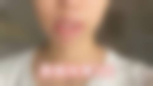 八、光山县尤锋整形医院真实的患者评价