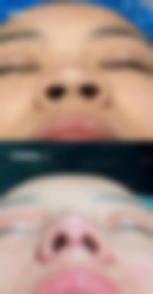 六、临沂艺生医疗美容门诊部价格表