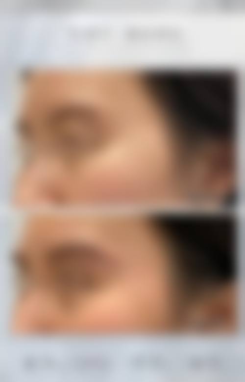 五、天津珍熙美医疗美容价格表