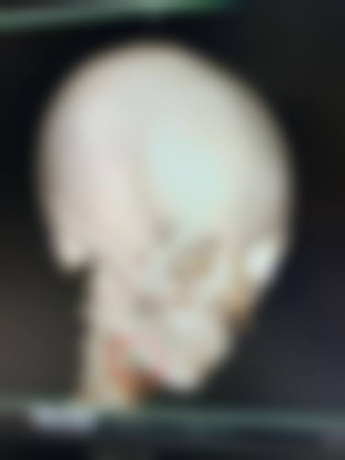 四、南京爱尚德美医疗整形美容特色项目