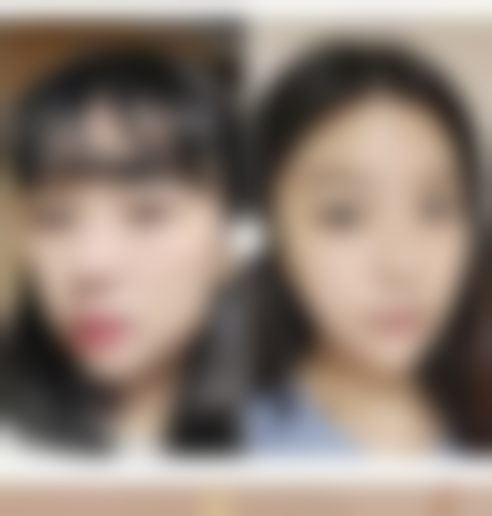 六、怎样去掉脸上的烫伤疤痕之美学修复建议