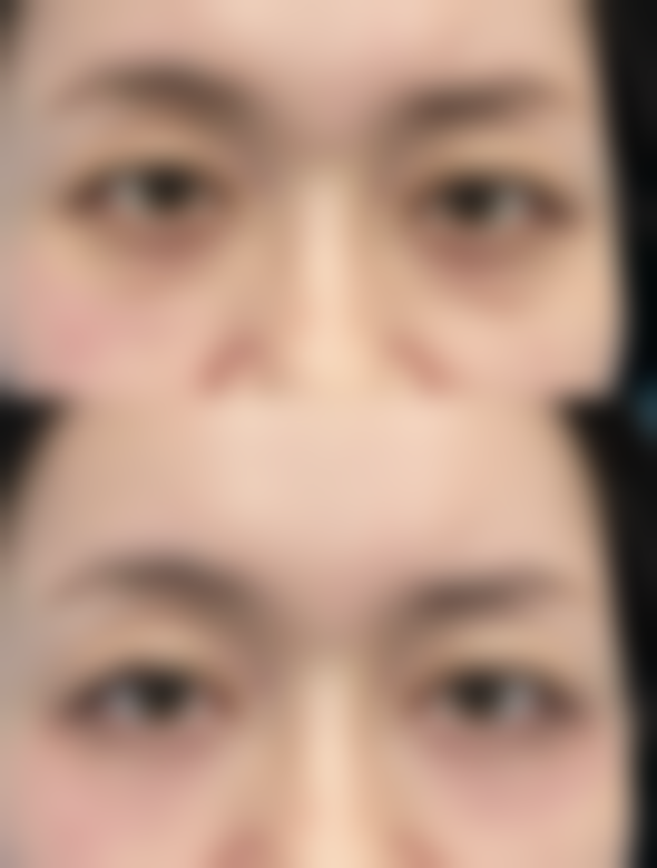 六、揭阳颐美医疗美容门诊部价格表