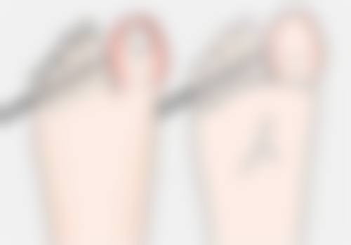 二、下颌缘吸脂一般吸多少