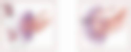 四、手术治疗方法