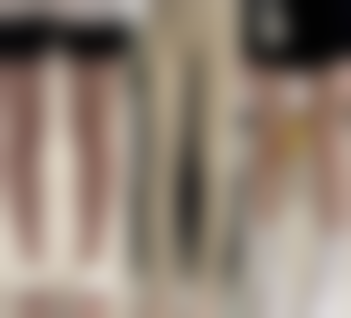 五、双眼皮疤痕修复的注意事项