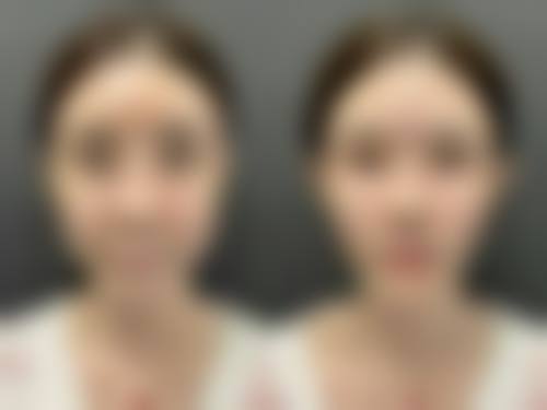 六、郭佩琼真实的患者评价