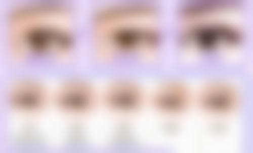 一、影响烫伤疤痕修复药膏选择的因素