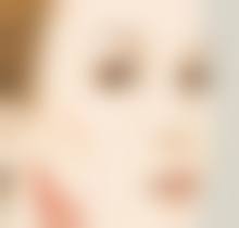 下颌缘吸脂一般吸多少？先了解下颌缘部位在哪，再看合适吸脂量 