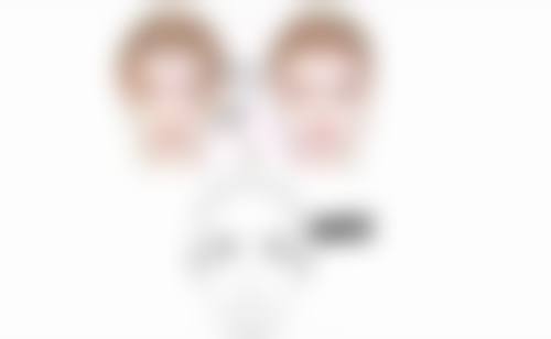 四、双眼皮疤痕修复的美学提示