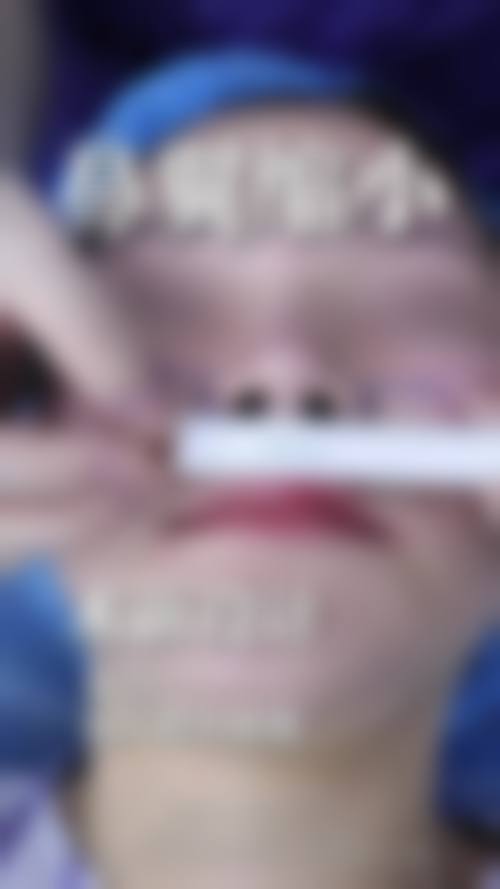 二、莆田涵江医院整形美容科怎么样？