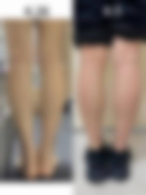 四、杭州艾玛医疗美容门诊部特色项目