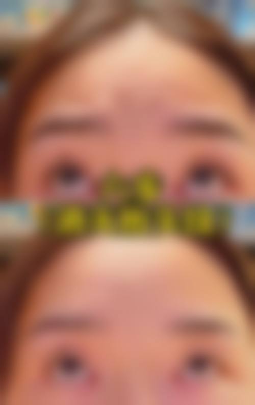 八、昆明博美医疗美容诊所真实的患者评价