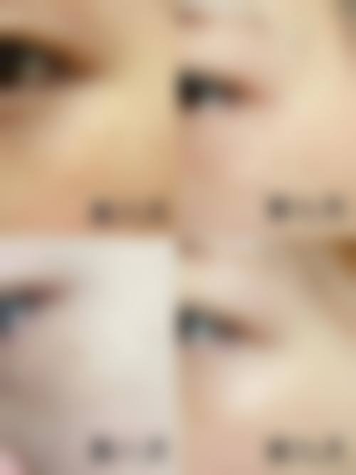 九、JAYJUN(捷埈)整形外科&皮肤科真实的患者评价