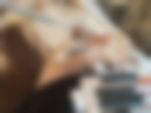 九、厦门思明碧莲盛医疗美容诊所真实的患者评价