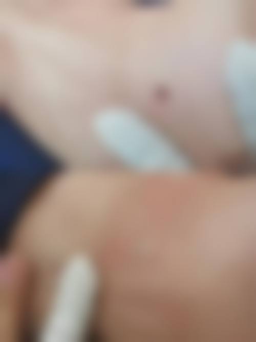 四、韩国格瑞丝整形外科医院特色项目