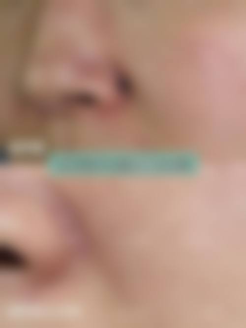 六、石家庄乐氏聚美医疗美容价格表