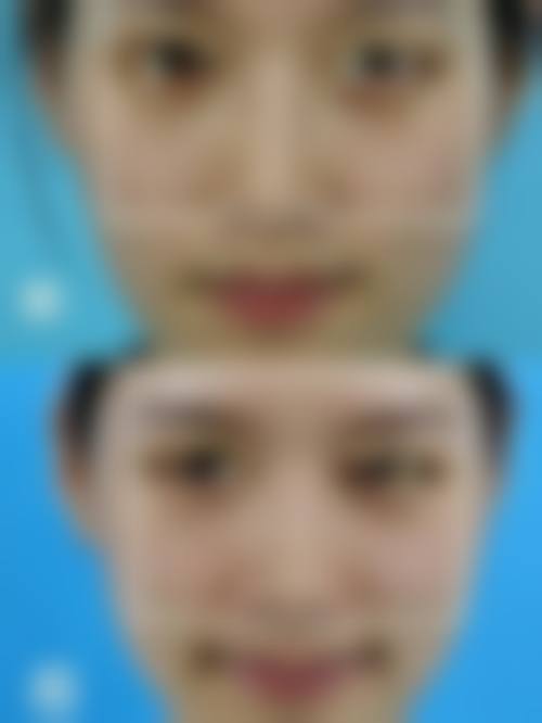 二、丹阳丽身华美医疗美容诊所怎么样？