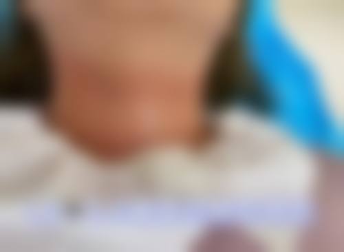 五、珠海方华医院整形美容科价格表