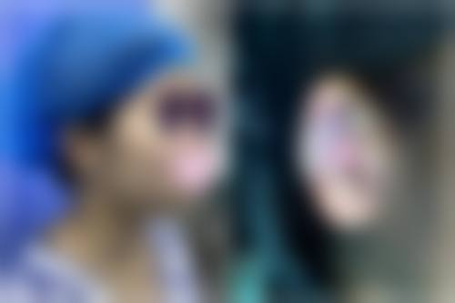 四、莆田涵江医院整形美容科特色项目