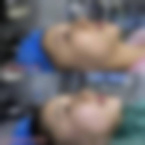 八、杭州艾玛医疗美容门诊部真实的患者评价