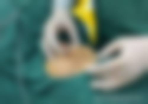 二、杭州艾玛医疗美容门诊部怎么样？