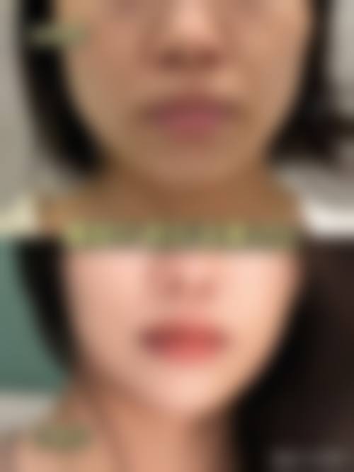 六、广州慕美整形医疗美容医院价格表