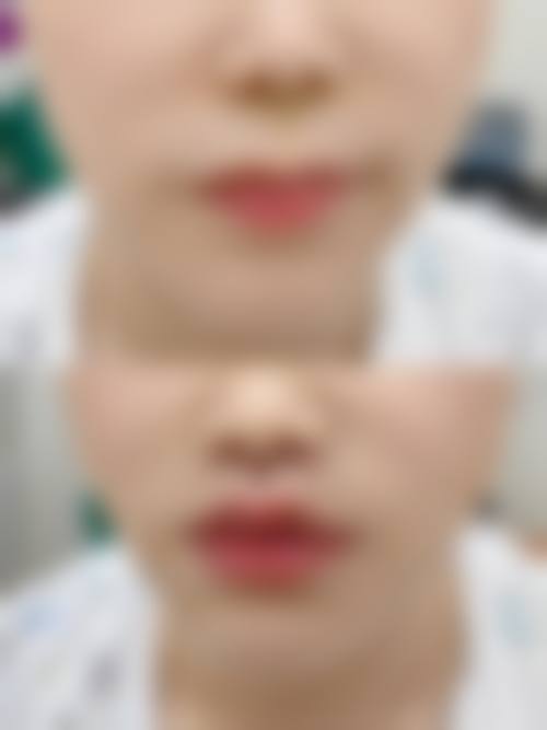 八、莆田涵江医院整形美容科真实的患者评价