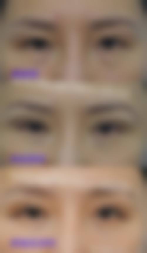 八、西安御美医疗整形美容医院预约方式