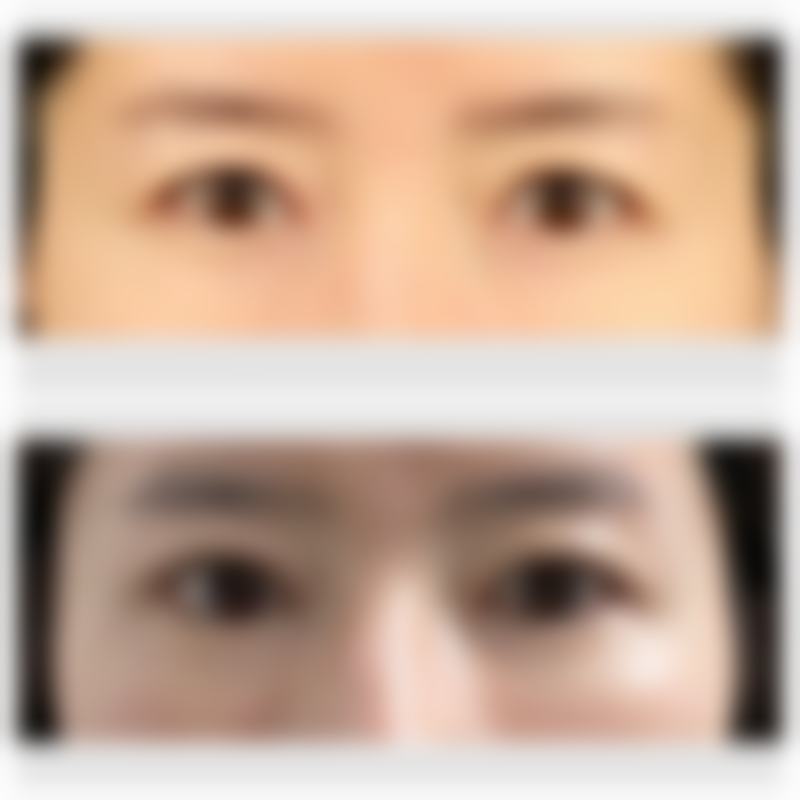 五、刘世铭怎么预约？