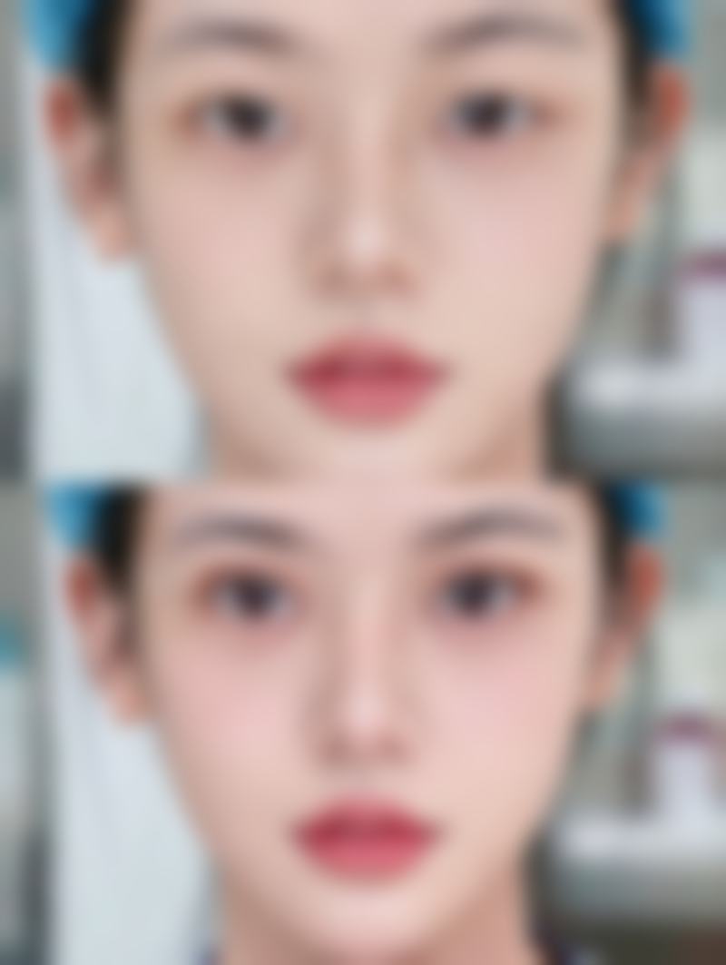 六、修复期间的心态调整