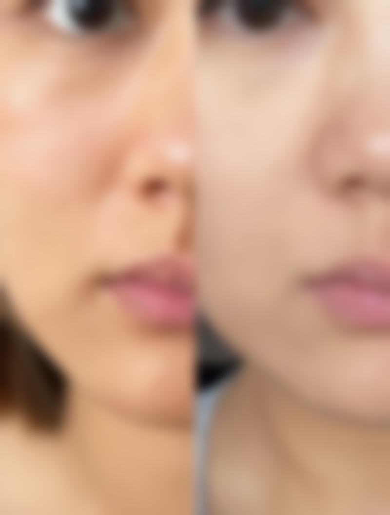 九、无锡臻美医疗美容门诊部真实的患者评价