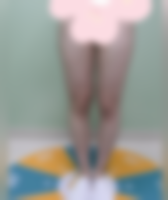 二、手术过程与感受