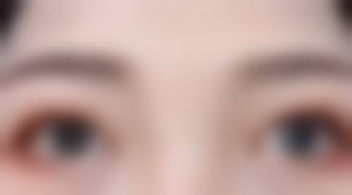 一、隆胸手术后疼痛肿胀的大致修复规律