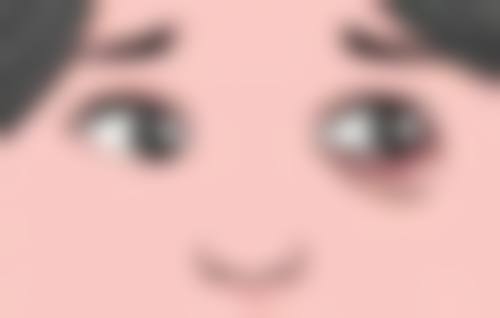 六、改善肿眼泡的医美方案参考（非必需）