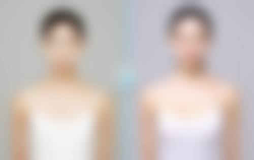 八、汕头中山大学附属汕头医院医学整形激光美容医院真实的患者评价