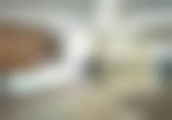 时隔半年到重庆星荣整形外科医院补针下巴，郑院长操作轻松效果明显服务还负责 