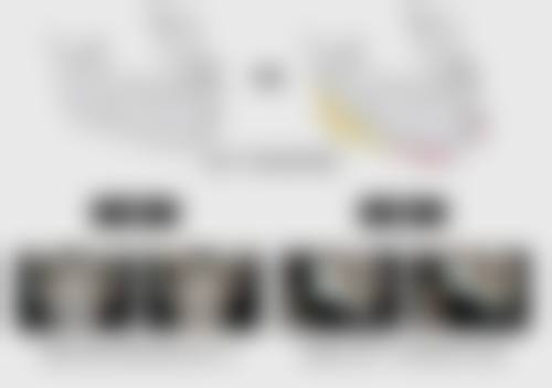 三、如何降低整容去眼袋后遗症的发生概率