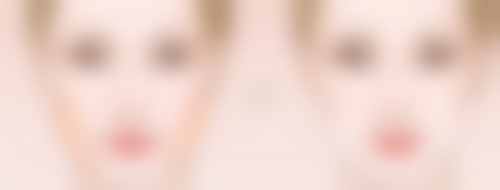 肿眼泡双眼皮怎么修复好？多种方案解析及注意事项助你科学变美 